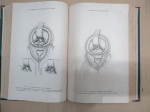 LA PRATIQUE CHIRURGICALE ILLUSTREÉ fascículos VI VII VIII