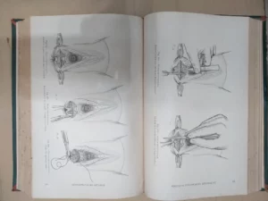 LA PRATIQUE CHIRURGICALE ILLUSTREÉ fascículos VI VII VIII