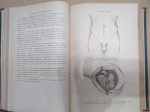 LA PRATIQUE CHIRURGICALE ILLUSTREÉ fascículos VI VII VIII