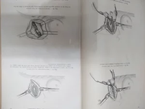 LA PRATIQUE CHIRURGICALE ILLUSTREÉ fascículos VI VII VIII